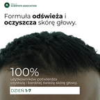 Anti-Hairloss Treatment