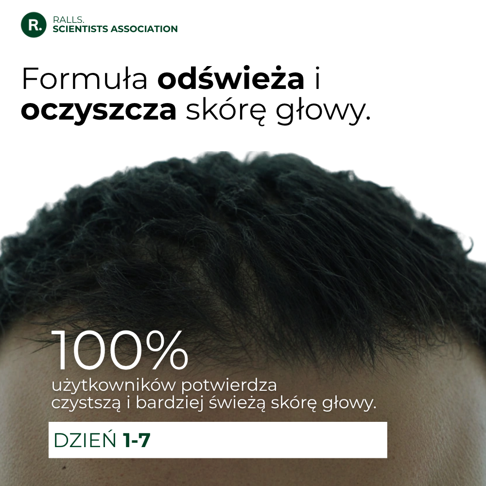 Anti-Hairloss Treatment