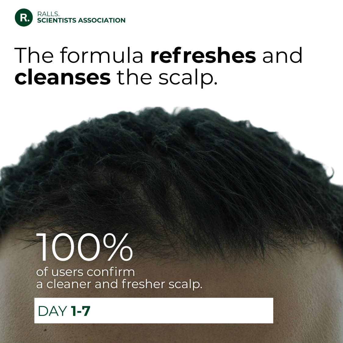 Anti-Hairloss Treatment