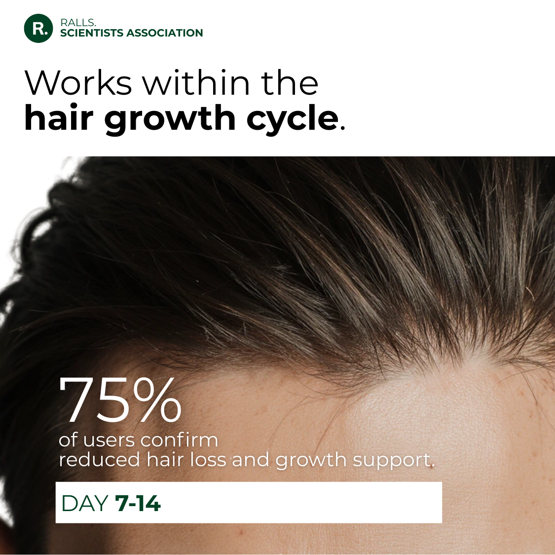 Anti-Hairloss Treatment