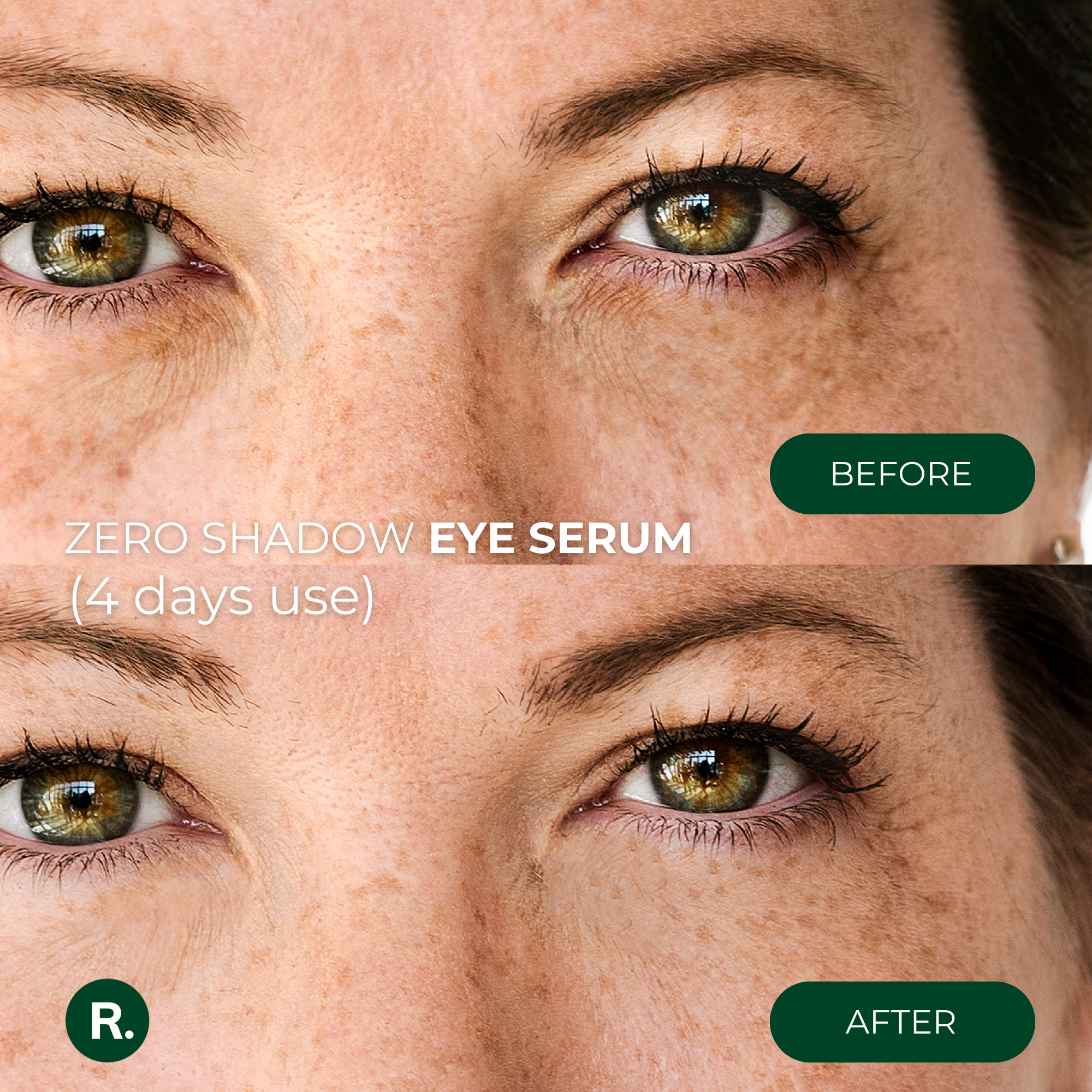 Eye kit that eliminates dark circles, puffiness and wrinkles