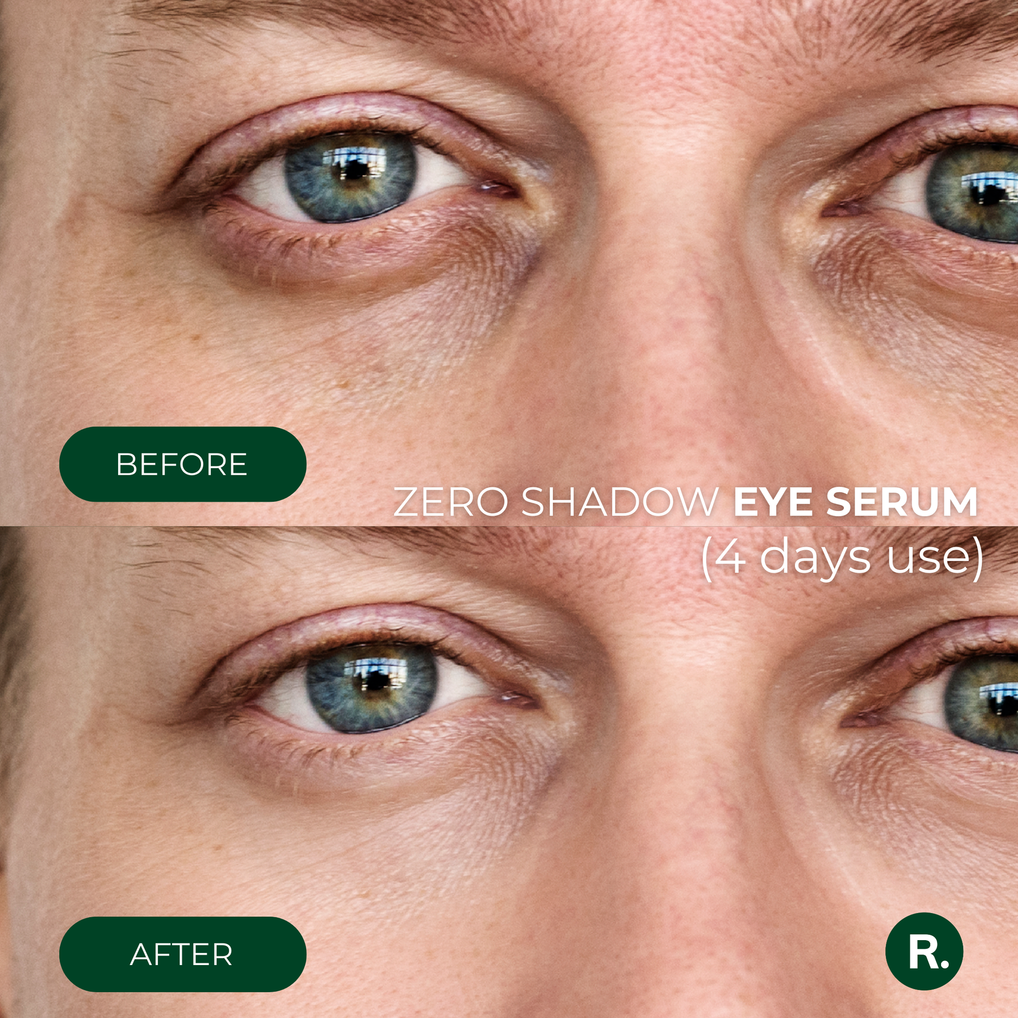 Eye serum against dark circles and puffiness