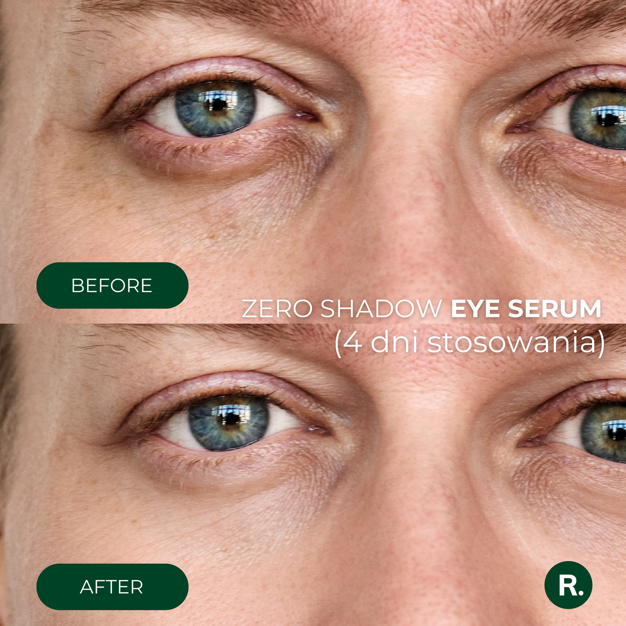 Zestaw pod oczy niwelujący cienie, obrzęki i zmarszczki